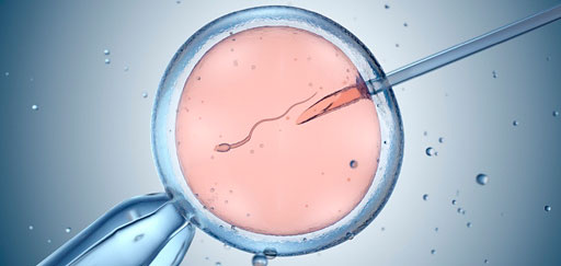 Экстракорпоральное оплодотворение: ЭКО (IVF) - 7 важных фактов о программе лечения